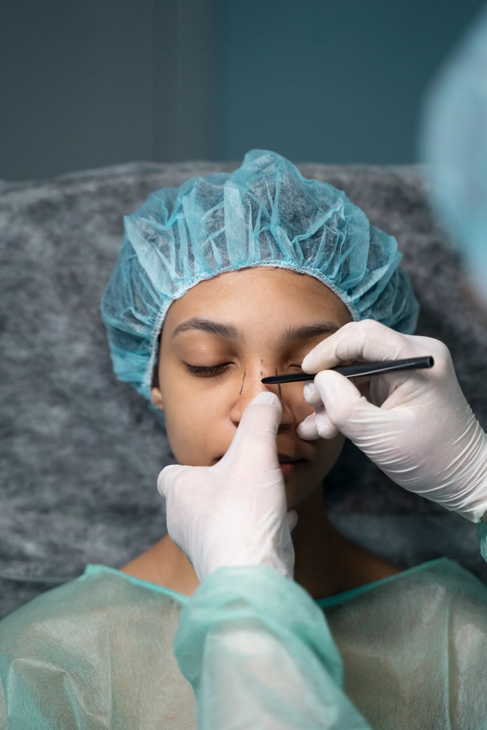 Ourense Cirugía Rinoplastia
